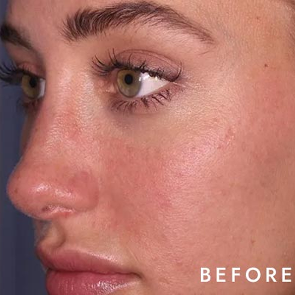 facial-treatment-before
